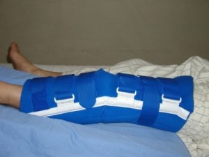 膝装具(ニーブレース)1